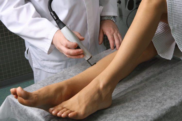 Varicose Veins: Things That You Need to Know